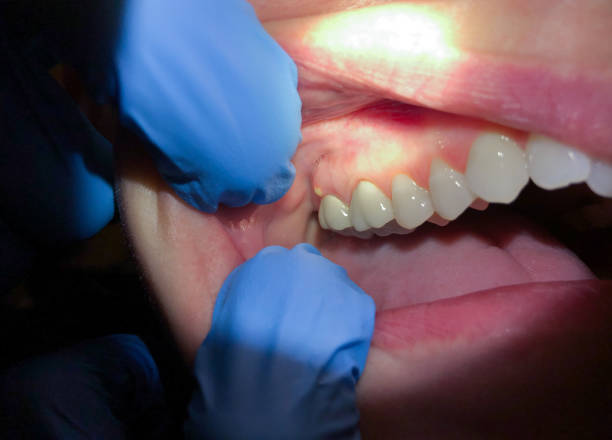 Best Emergency Dental Services for Seniors in Wyndham, VA